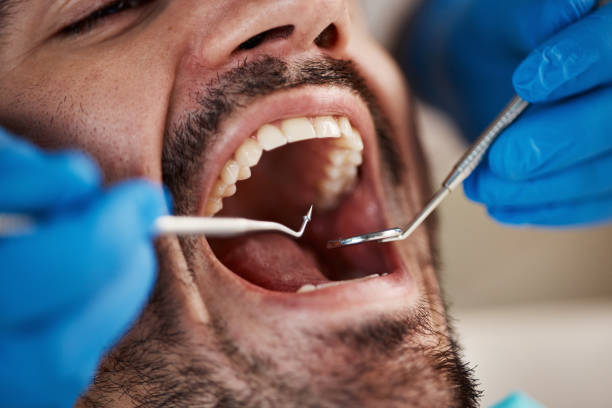 Best Emergency TMJ Treatment in Aspen Hill, MD