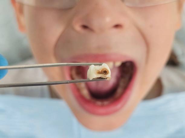 Best Cosmetic Emergency Dentistry in Aspen Hill, MD
